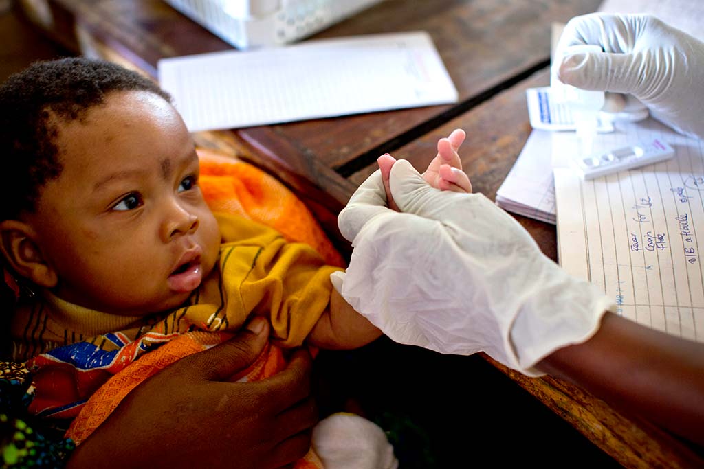 A baby in Tanzania being tested for malaria